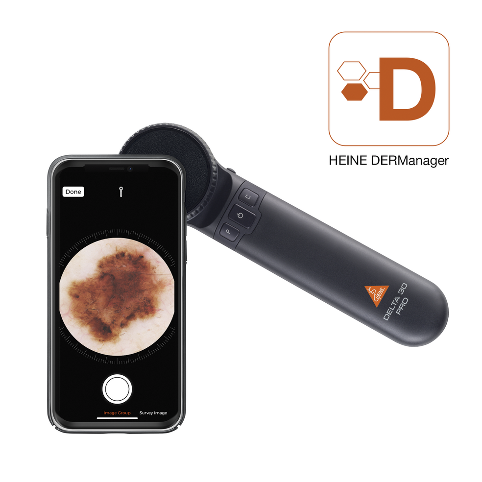 HEINE - DELTA 30 Pro Dermatoscope